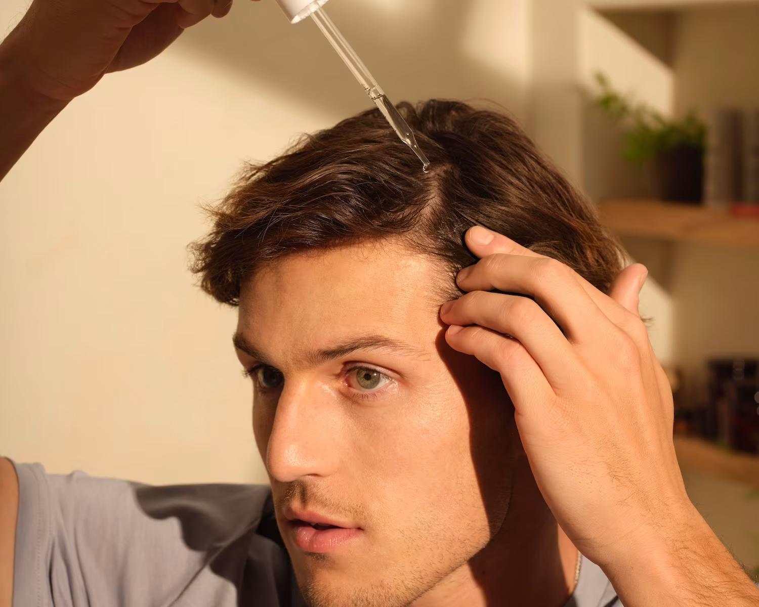 9 Causes of Hair Thinning In Men